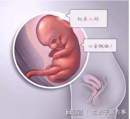 染色体易位